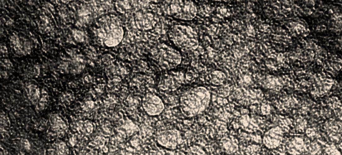 フュージョン・ナノ計測基盤装置